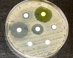 چگونه باکتری‌ها برای فرار از آنتی‌بیوتیک‌ها درکنار هم مانند یک ارگانیسم واحد عمل می‌کنند