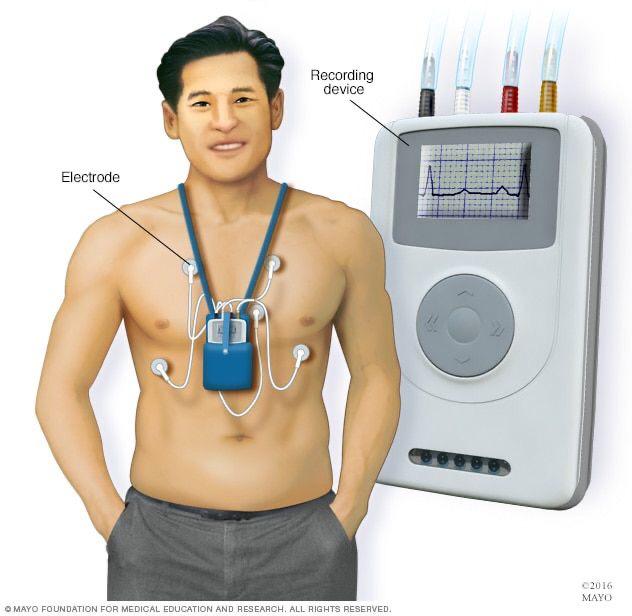 holter heart monitor