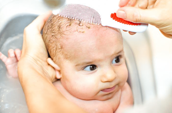 استفاده از شانه برای جدا کردن پوسته سر نوزاد- کلاهک گهواره