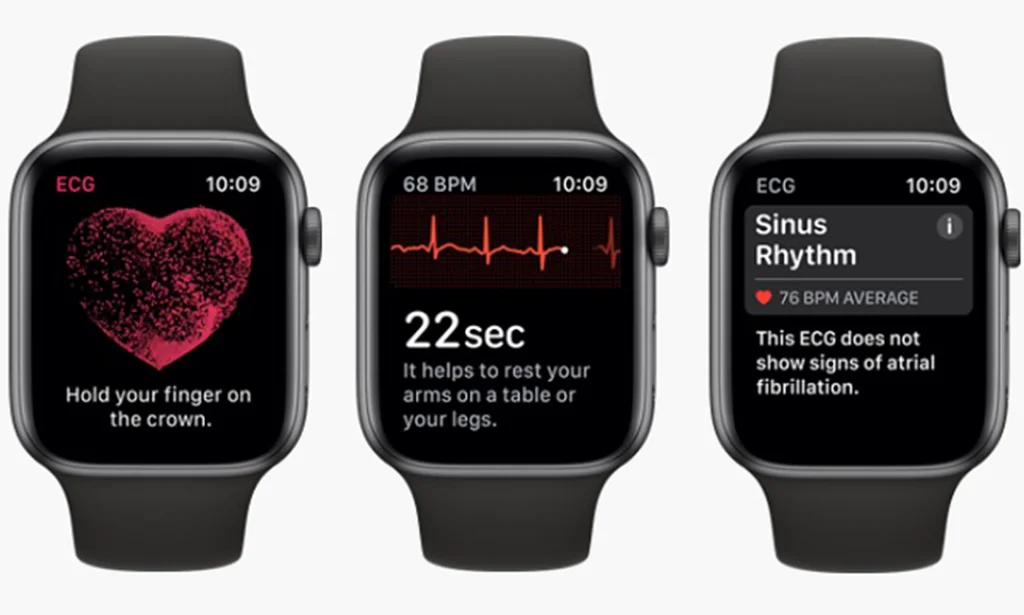 اپل واچ در حال نمایش نوار قلب ECG و متصل به یک آیفون روی میز