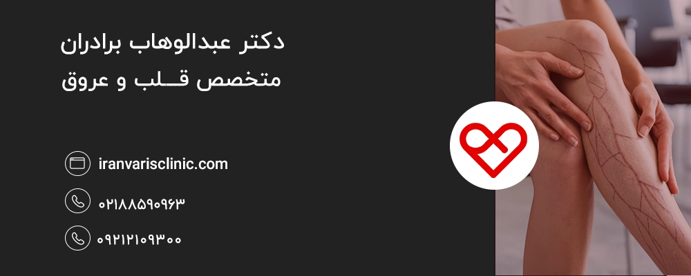 چه رژیم غذایی به درمان واریس کمک میکند؟ راهنمای کامل + نکات تخصصی