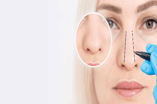 آیا بینی گوشتی بعد از عمل برمی‌گردد؟ ۵ دلیل و راه‌های جلوگیری