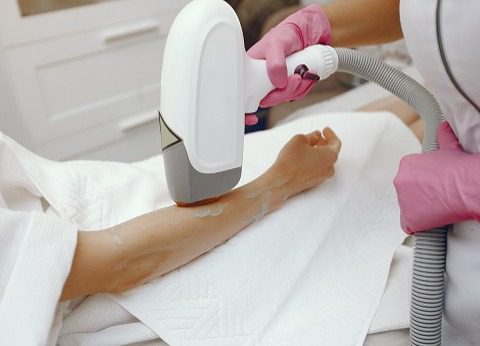 7 نکته برای گرفتن بهترین نتیجه از لیزر موهای زائد