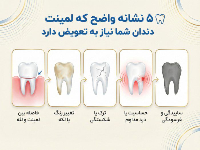 چه زمانی لمینتها نیاز به تعویض دارند؟