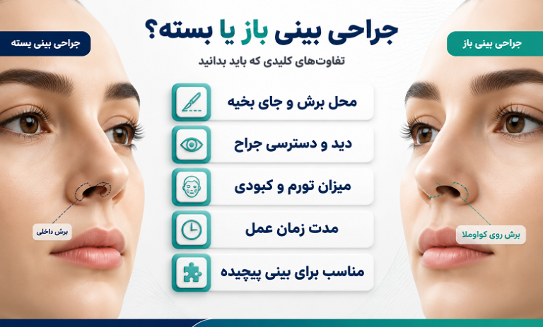 مهمترین تفاوت جراحی بینی باز و بسته که لازم است بدانید!
