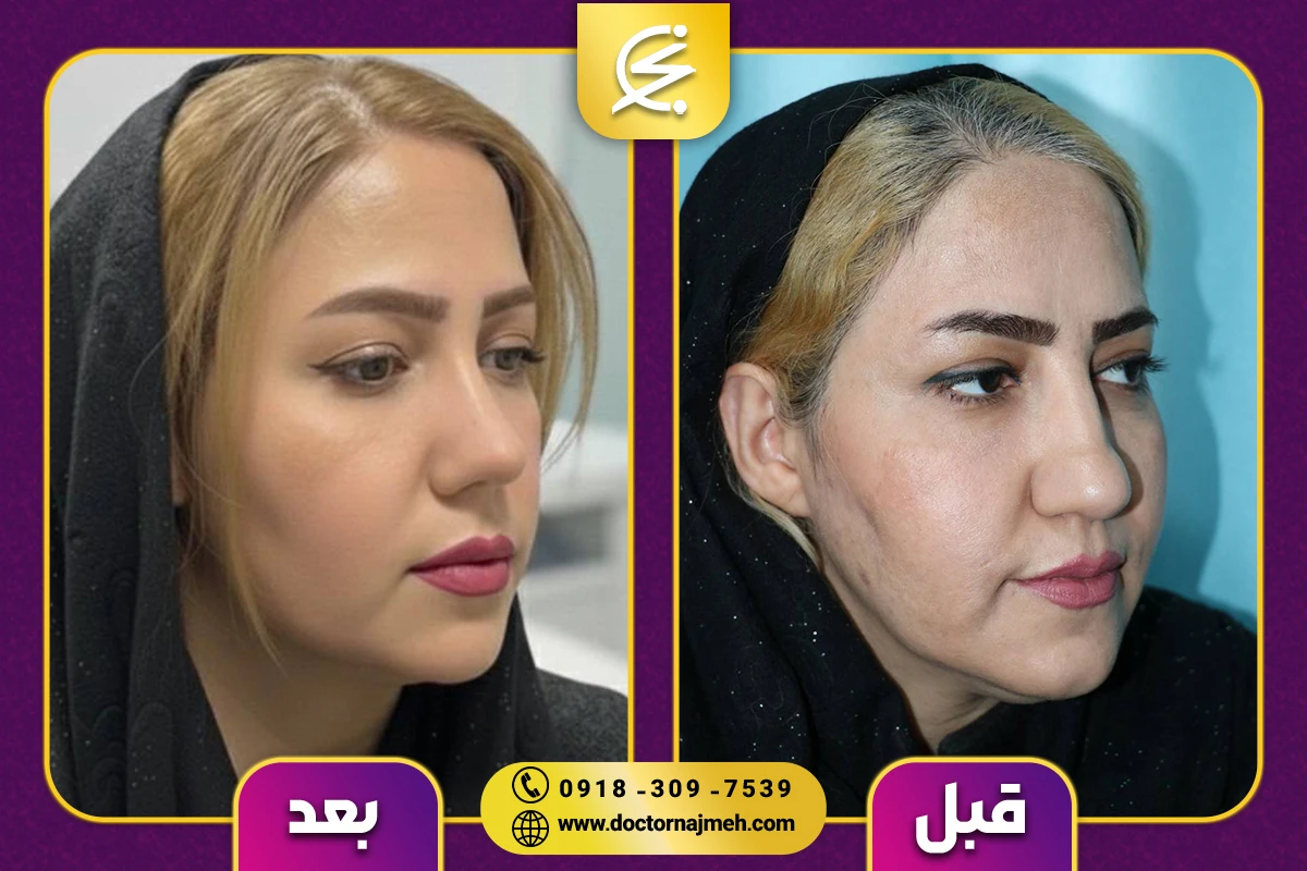 نمونه کار دکتر نجمه برخورداری یزدی