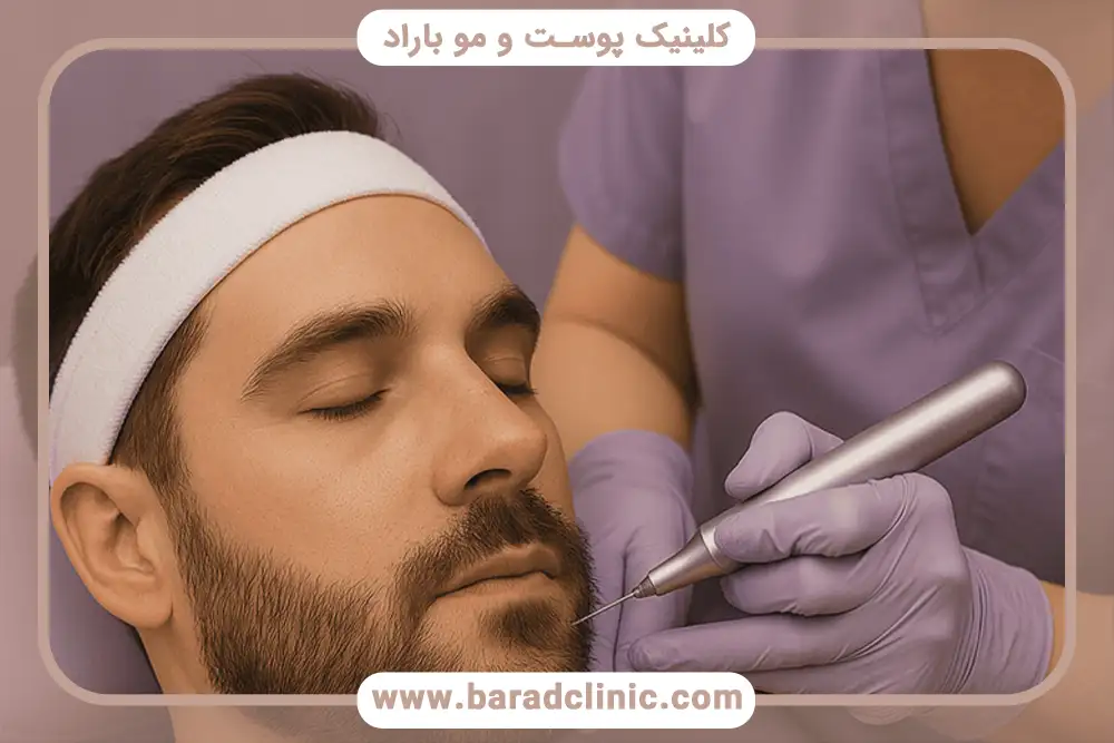 مراحل و انواع خدمات کاشت ریش