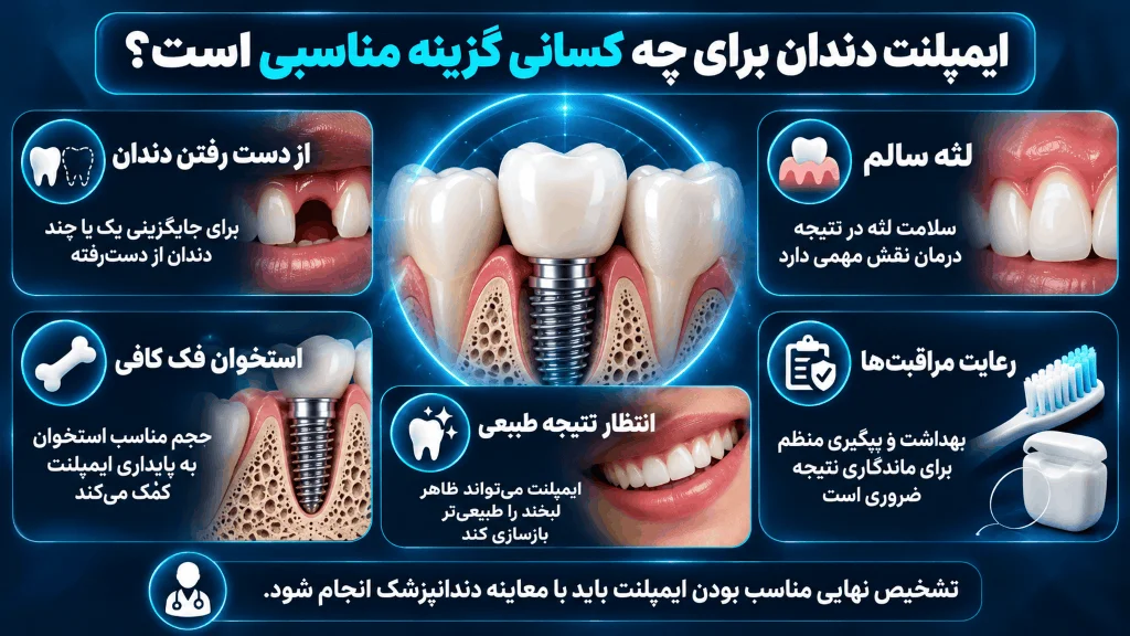 شرایط ایمپلنت دندان برای زیبایی لبخند طبیعی کپی